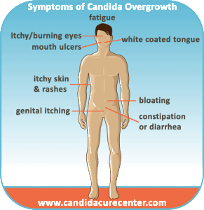 candida symptoms albicans infection overgrowth yeast signs candidiasis systemic system fungal folds fat cure explained digestive show when nervous emotional